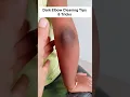 Lagu Remove Elbow Darkness In Just 5 Mins | Lighten Dark Elbow, Dark Elbow Cleaning Tips #darkskin #hack
