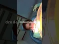 Sizing up orthodontic bands and impression tray pickup - dr adel zakhary