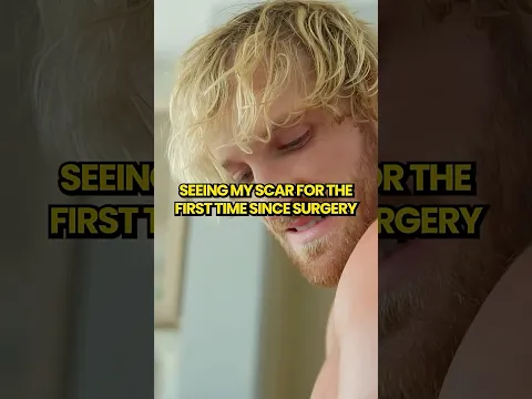 SEEING MY SCAR FOR THE FIRST TIME SINCE SURGERY #loganpaul #wwe #shorts