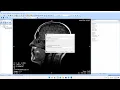 Anonymize DICOM images