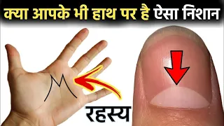 केवल 5 % लोगो के नाखून पर होते है ऐसे निशान । अगर आपके भी है तो जान लीजिए रहस्य