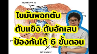 ภาวะไขมันพอกตับเกิดจากสาเหตุอะไรบ้าง