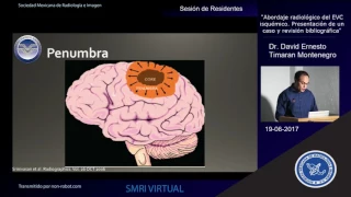 Abordaje Radiológico del EVC isquémico