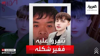 رجل أجرى 9 عمليات تجميل لن تتخيل التغيير 