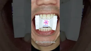 Here S The Viral Video Everyone Is Sharing On YouTube DoctorTristanPeh ASMR See More 