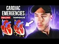Cardiac Emergencies EMT School 3 Emergencies You Can t Miss