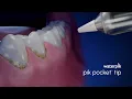 Waterpik Pik Pocket Tip