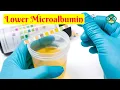 How to Lower Microalbumin How to Reduce Urine Microalbumin How to Lower Albumin Creatinine Ratio