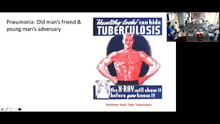 Pneumonia from a Pulmonologist