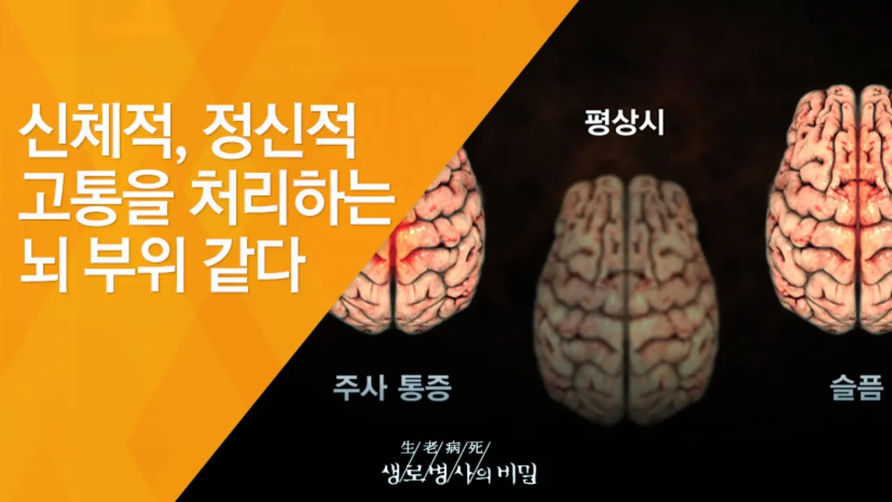 신체적, 정신적 고통을 처리하는 뇌 부위 같다 - (20130424_신인류의 조건 - 3회 방송)_공사창립 40주년 특집 100세시대, 신인류의 조건 제3부 장수의 힘, 어울림