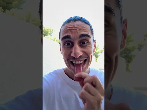 JE PRANK UN DENTISTE AVEC DES DENTS CASSÉES ! @drNever