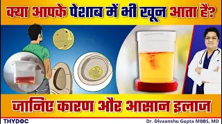  hematuria treatment 