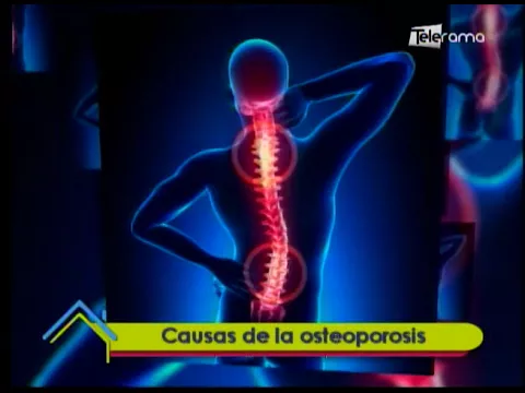 Causas de la osteoporosis