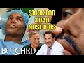 Norwood Spent 100k on THREE Nose Jobs That Hurt His Music Career Before After Botched E