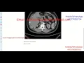 Kidney Stone Identification Using Image Processing Python Project With Source Code Kidney Stone