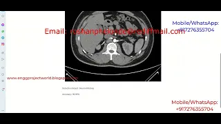 Kidney Stone Identification Using Image Processing Python Project With Source Code Kidney Stone