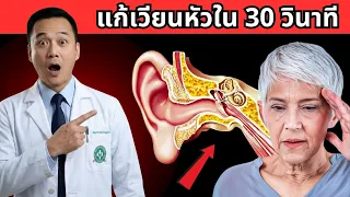 โรคหินปูนในหูหลุด มีชื่อทางการแพทย์ว่าอะไร