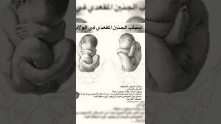 شكل الجنين المقعدى سبحان الله العظيم دندنها