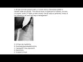 COMLEX LEVEL 3 High Yield Gastro