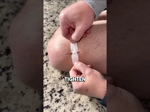 This Tool Closes Wounds Without Stitches!