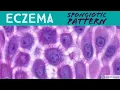 Contact Dermatitis etc Spongiotic Dermatitis Pattern - Inflammatory Dermpath Basics