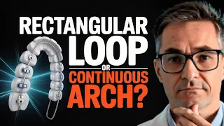 Rectangular Loop or Continuous Arch Essential Biomechanics