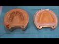 Processing of Complete dentures