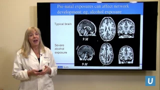 How Does a Child's Brain Develop? | Susan Y. Bookheimer PhD | UCLAMDChat