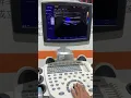 Download Lagu Demo Emperor G70 with Linear probe Color doppler Ultrasound machine Call 03214447817