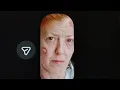 My Public Cancer Journey last year-I was trolled for it then a smear campaign is being tried again