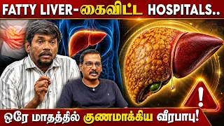 Fatty Liver-கைவிட்ட Hospitals.. ஒரே மாதத்தில் குணமாக்கிய Dr.வீரபாபு! OSB | Dr.Veerababu