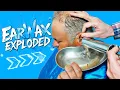 Ear Wax Exploded | Best Ear wax Removal #earwaxremoval #earwaxremoving #earwaxcleaning