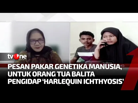 Keterangan Pakar Genetika soal Bayi Genetik 'Harlequin Ichthyosis'