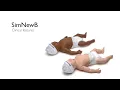 SimNewB - Clinical Features