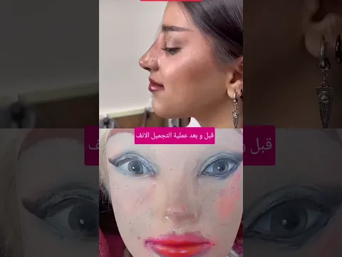 قبل و بعد عملية الانف #مكياج_سينمائي #مايكاب #makeupartist #تجميل