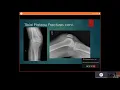 Knee X ray teaching
