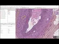 Project creation and annotations with QuPath