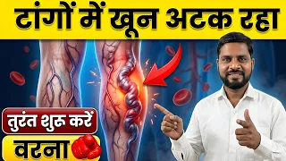 "टांगों में रुका खून स्पीड से दौड़ेगा | Varicose Veins Exercises At Home