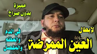 رقية مميزة لإبطال العين الممرضة في الدم والعظام والمفاصل الراقي المغربي نعيم ربيع 