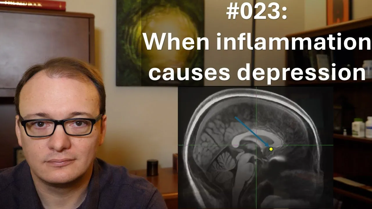 023 - Inflammation causes depression