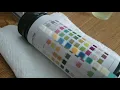 How To Read Urine Test Strips