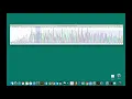 Sequence Analysis Protocol - Determine Genotype of ACTN3