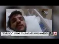 A man who says he was stabbed in Hudson Falls is speaking out