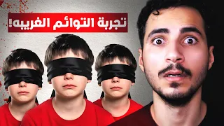 تجربة فصل التوائم السرية | واقعي