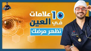 عشرة علامات فى العين تخبرك عن حالتك الصحية لاتغفل عنهم ابدا 