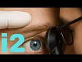 Download Lagu A Day at the Hospital – Eye Tests, Vascular Scans \u0026 Honest Thoughts