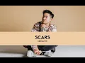Download Lagu SCARS - KEENAN TE (LIRIK LAGU)