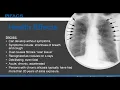 Silica Asbestos Regulatory Updates in the Construction Industry Webinar - 06 28 18