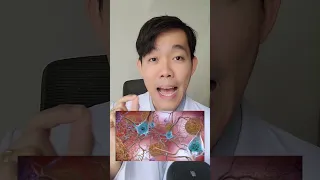  โรคอัลไซเมอร์เกิดจากอะไร และมีวิธีป้องกันอย่างไรบ้าง 