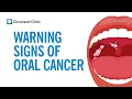 Download Lagu How To Screen Yourself for Oral Cancer
